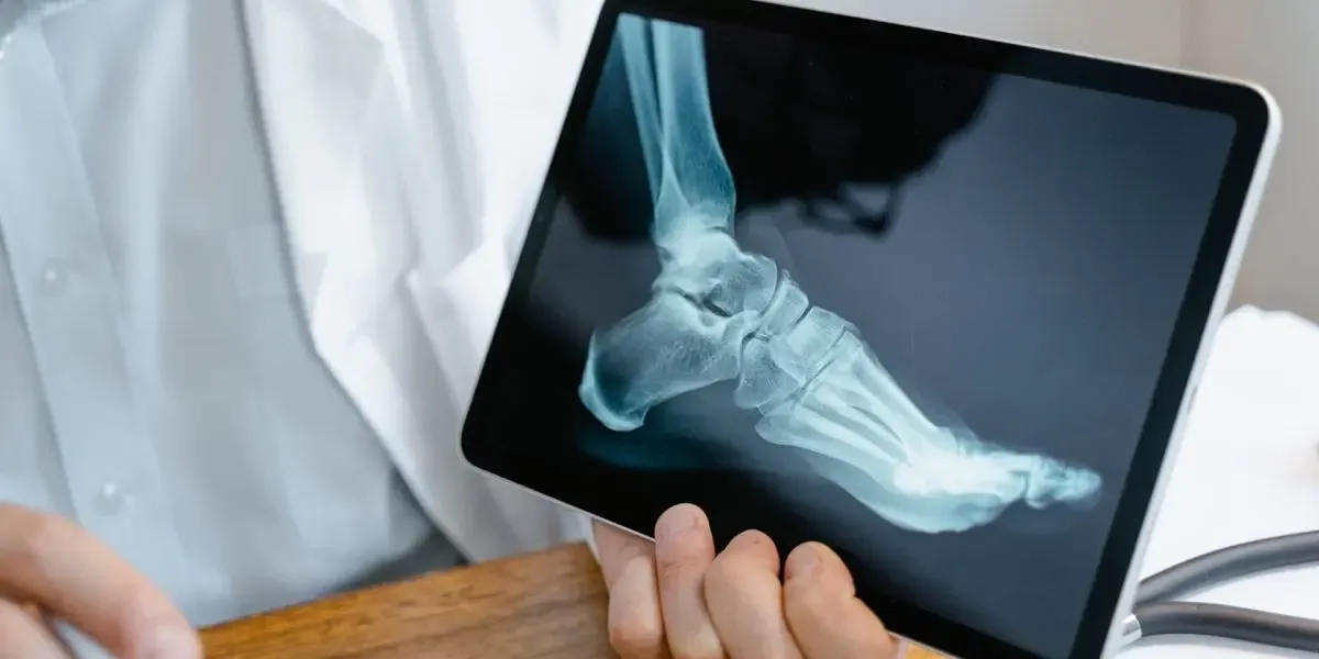 How Much is an X-Ray? X-Ray Cost vs. ER X-Ray Cost