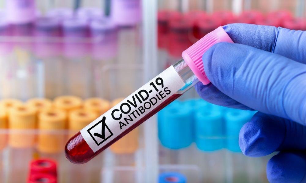 Understanding the Different Types of COVID-19 Tests