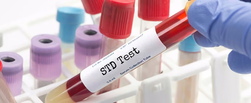std testing in Ooltewah Tennessee
