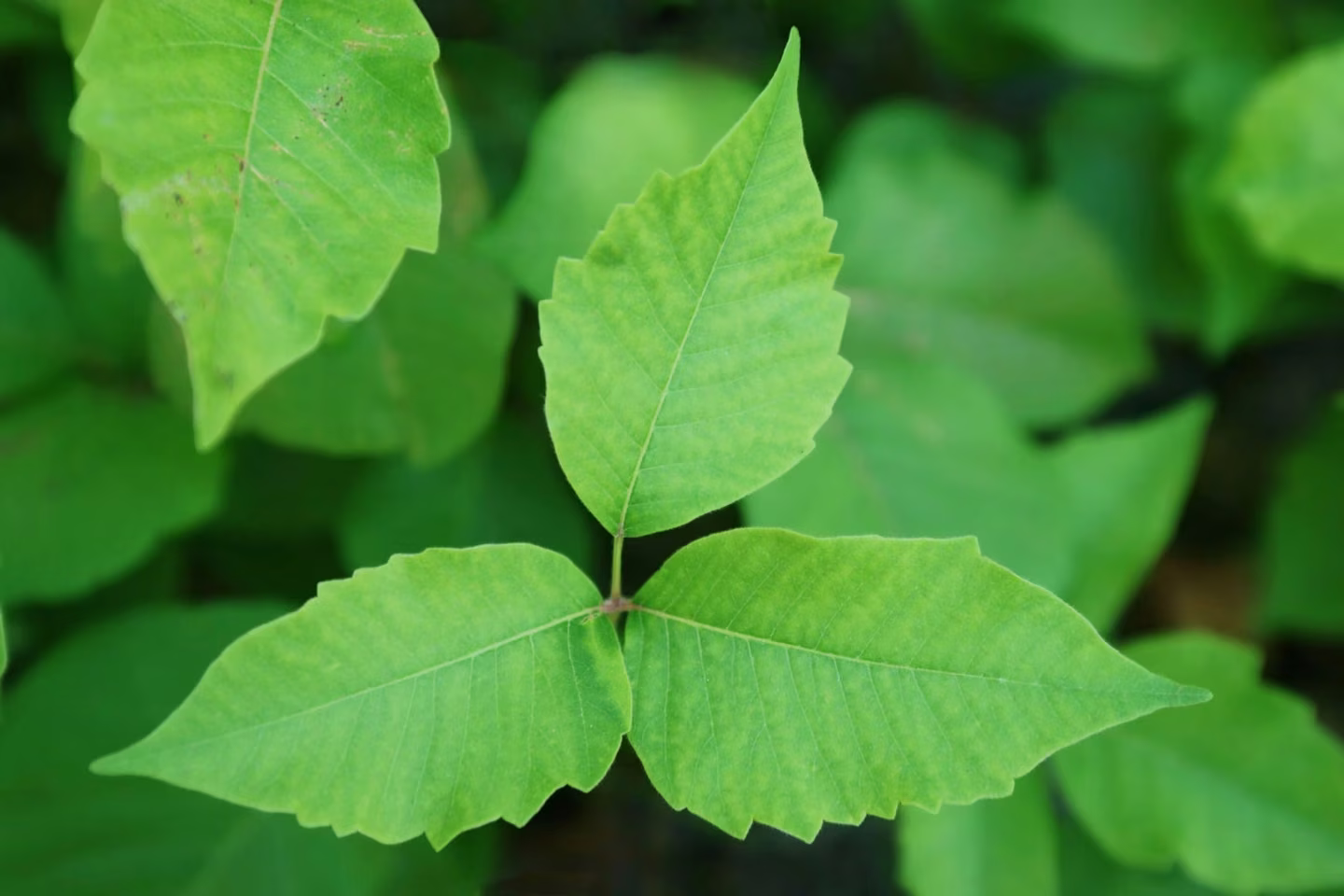 From Contact to Recovery: Demystifying Poison Ivy Rash Stages