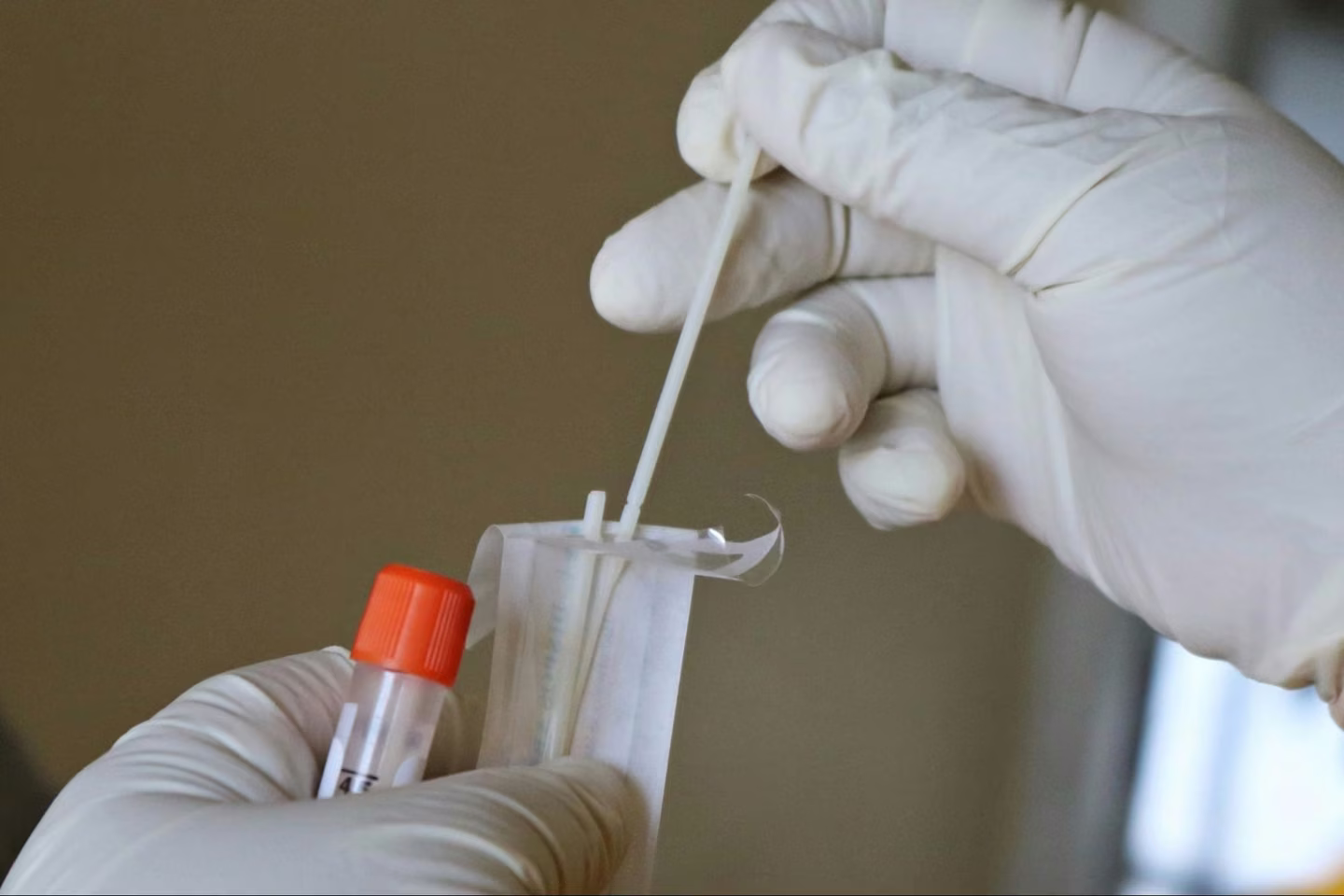 How Long Does an STD Screening Take? What to Expect at Urgent Care