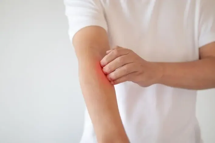 Simple Tips for your Winter Skin Woes