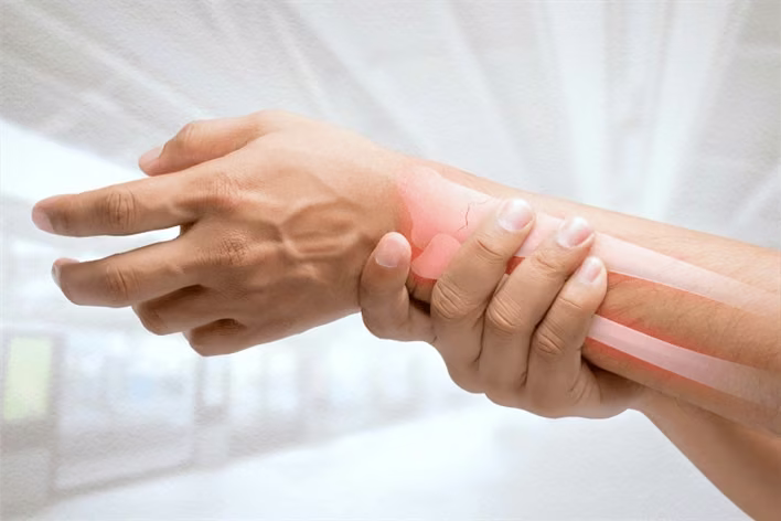 The Facts of Osteoporosis