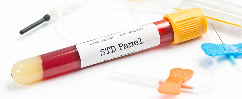 How Often Do I Need to Come in for an STD Test?