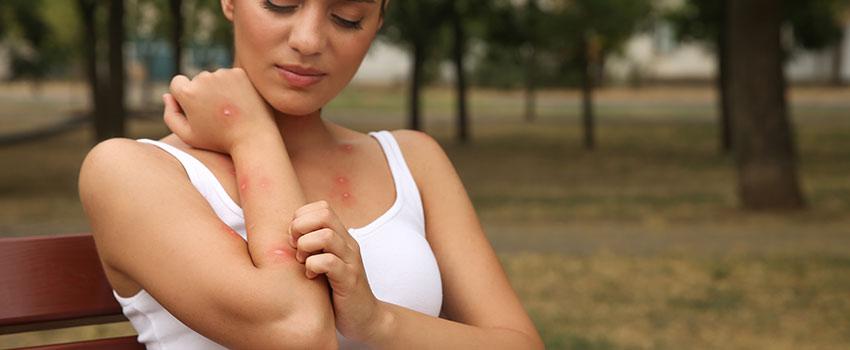 Woman with bug bite in her arm