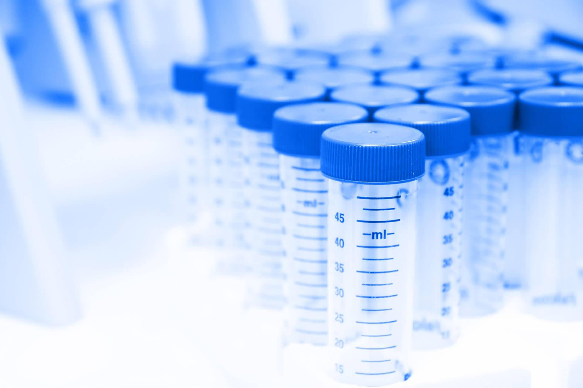 A set of plastic conatiners used for STD testing