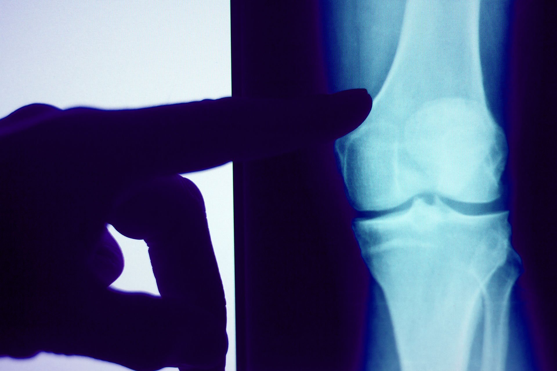 Hand pointing at an X-Ray in low lighting.