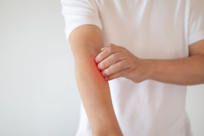 Person in a white short-sleeved shirt scratching their irritated, red forearm with their other hand, contemplating whether to visit the medical center.