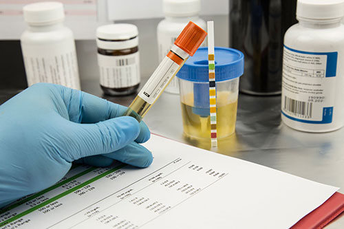 A gloved hand holds a urine test sample next to a urine test strip, with medical bottles and paperwork in the background at an urgent care facility.