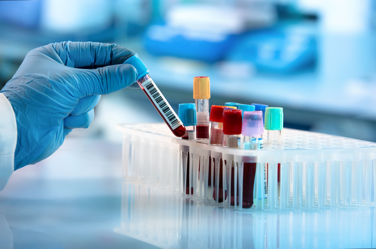 AFC Somerset for Lab Testing