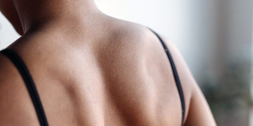 Close-up of a person's upper back and shoulders, showing smooth skin and defined shoulder blades, with black bra straps visible. The care taken by American Family Care enhances their natural glow.