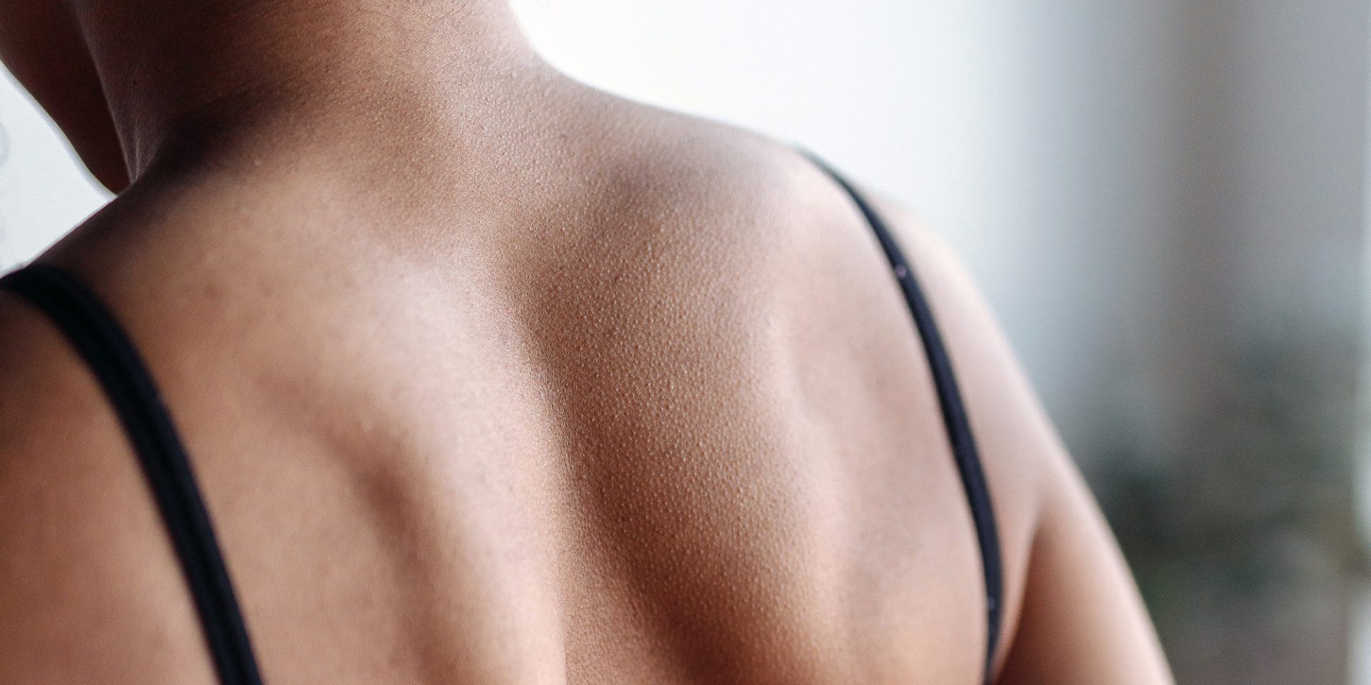 Close-up of a person's upper back and shoulders, showing smooth skin and defined shoulder blades, with black bra straps visible. The care taken by American Family Care enhances their natural glow.