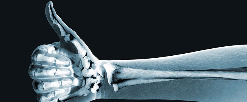 What Do I Need to Know About X-rays?