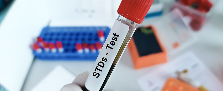What STD Tests Are Available at AFC?