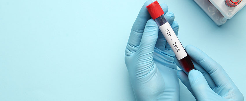 When Should I Seek Out an STD Test?