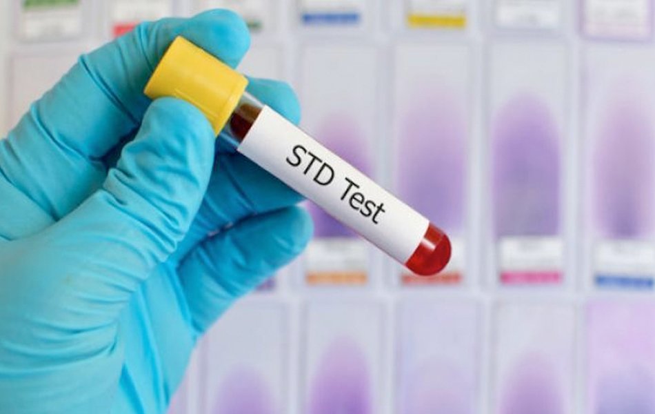 How Long Does an STD Screening Take?