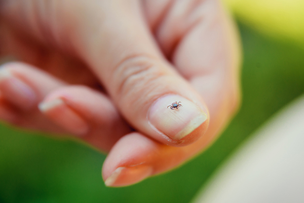 How Do You Know if You Have Been Bit by a Tick?