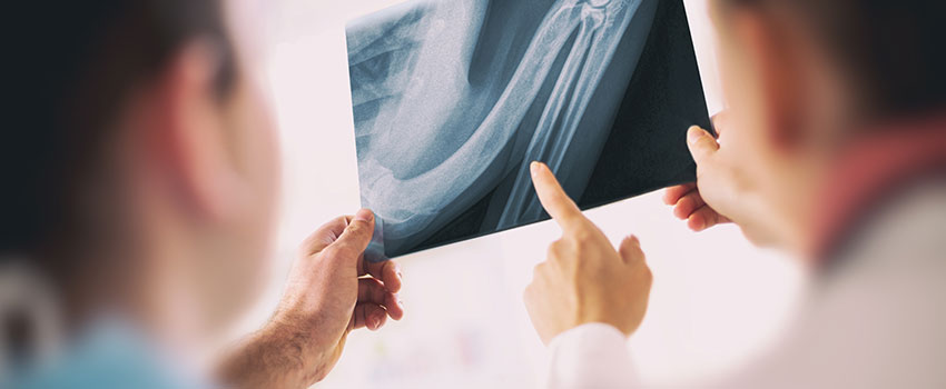 Are X-rays Really Necessary?