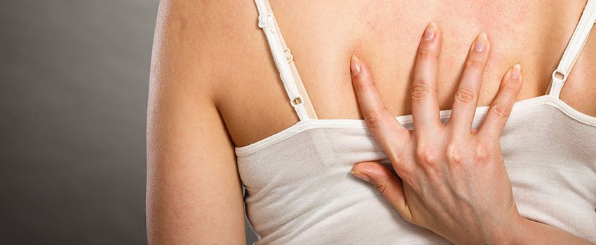 Can I Treat a Rash at Home?