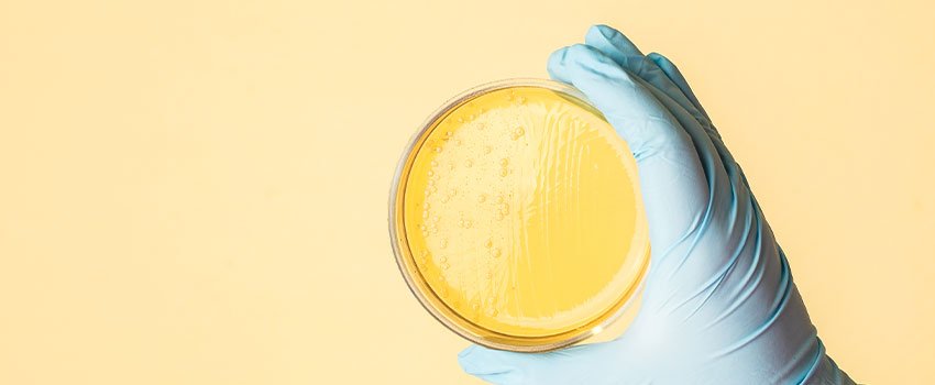 Are UTIs and Yeast Infections the Same Things?