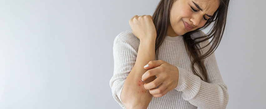 What Should I Know About Eczema?