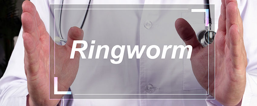 What Do I Need to Know About Ringworm?