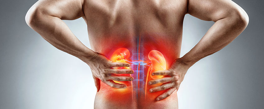 What Do I Need to Know About Kidney Stones?￼
