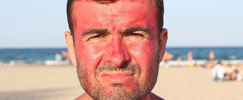Who Is at Risk of Getting Skin Cancer?