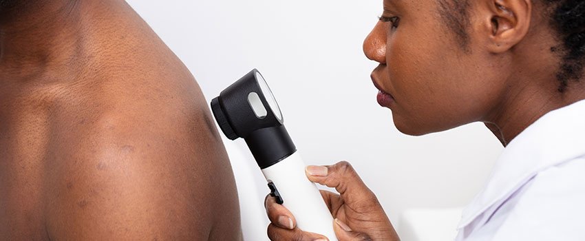 What Skin Changes Should I Worry About?