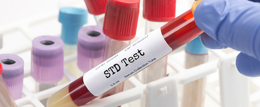 What Happens if I Don’t Treat an STD?