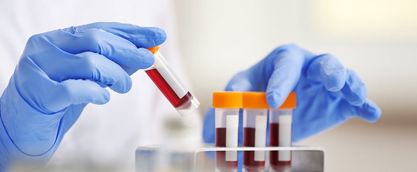 Do Each of the AFC Urgent Care TN Locations Have a Lab?