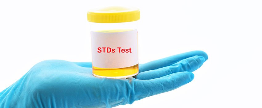 Do AFC Urgent Care TN Centers Treat STDs?