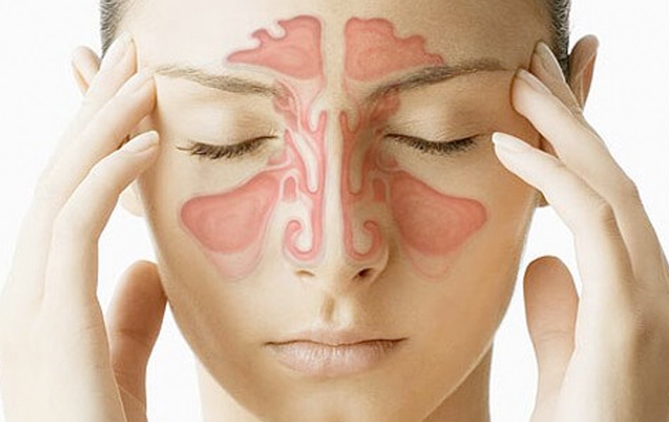 How Long Does a Sinus Infection Last?- AFC Urgent Care
