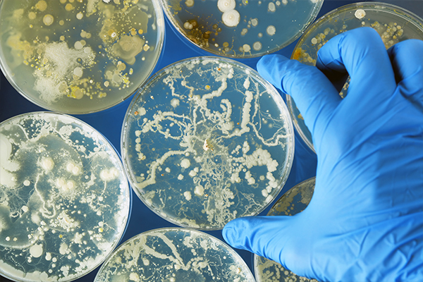 What Is the Difference Between a Bacterial Infection and a Viral Infection?