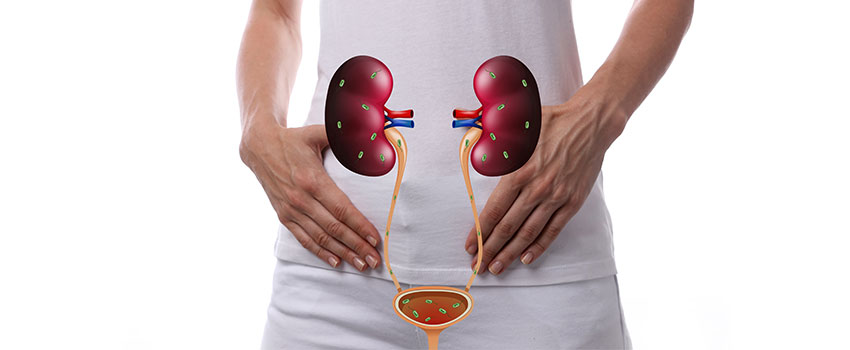 Can I Treat My Kidney Infection at Home?- AFC Urgent Care