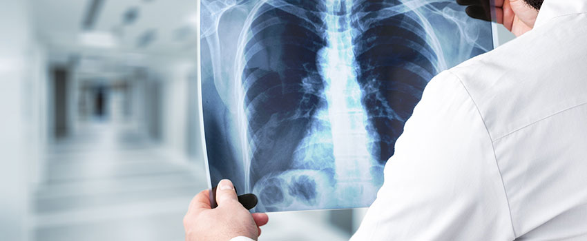 Should I Be Worried About Getting an X-ray?- AFC Urgent Care