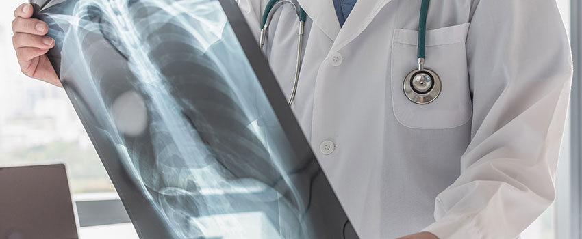 When Should I Get an X-ray?
