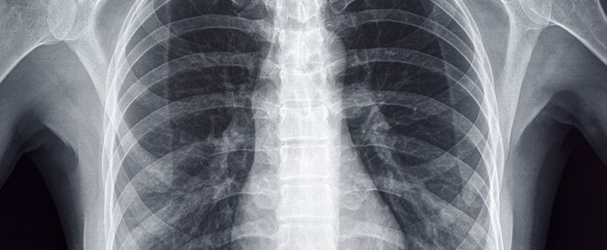 How Do I Know If I Need an X-ray?