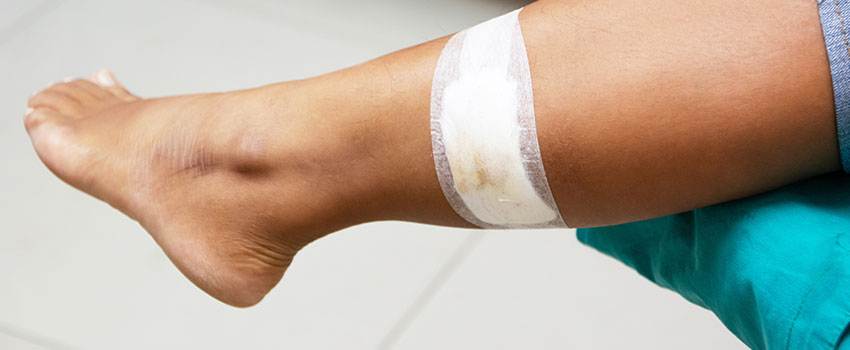 When to Seek Medical Attention for Your Laceration- AFC Urgent Care