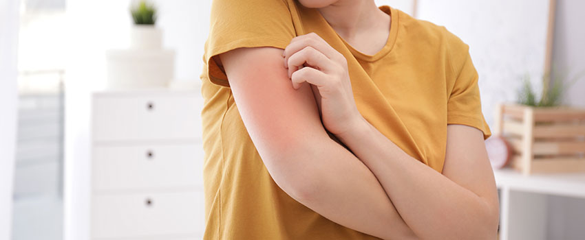What Does It Mean If I Have a Rash?- AFC Urgent Care