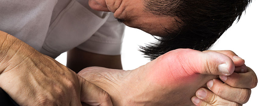 What to Know About Gout- AFC Urgent Care