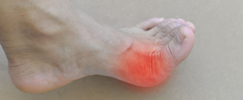 What You Should Know About Gout- AFC Urgent Care