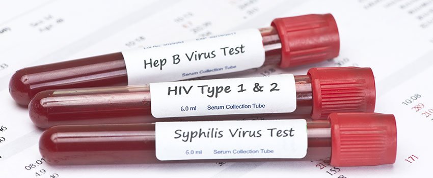 What Do I Need to Know About STD Testing?- AFC Urgent Care