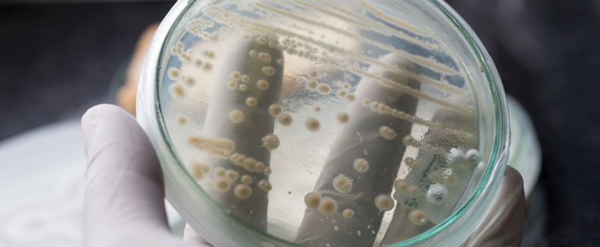 Can Yeast Infections Only Happen to Women?- AFC Urgent Care