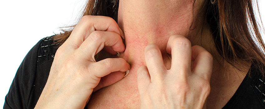 Is It Possible to Treat Eczema?- AFC Urgent Care