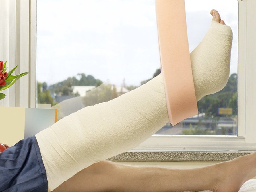 How to Recover From a Broken Leg- AFC Urgent Care