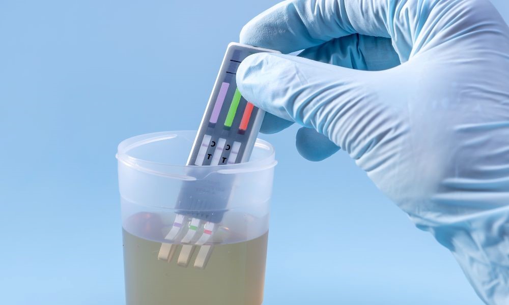Employee Drug Testing: What Substances Are Screened For?