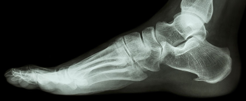 Does AFC Urgent Care Dalton Offer X-ray Services?