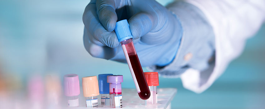 Does AFC Urgent Care Dalton Have a Lab on Site?