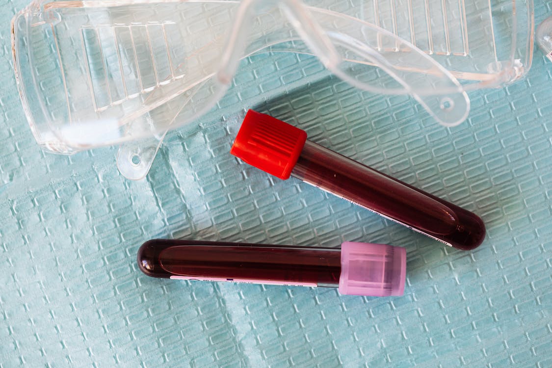 This blog post will go over the importance of consistent STD testing, both for individual wellness as well as for public health and safety.